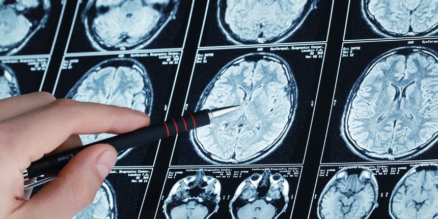 Tumeur au cerveau, qu'est ce que c'est ? Qu'est ce qu'une tumeur cérébrale ?