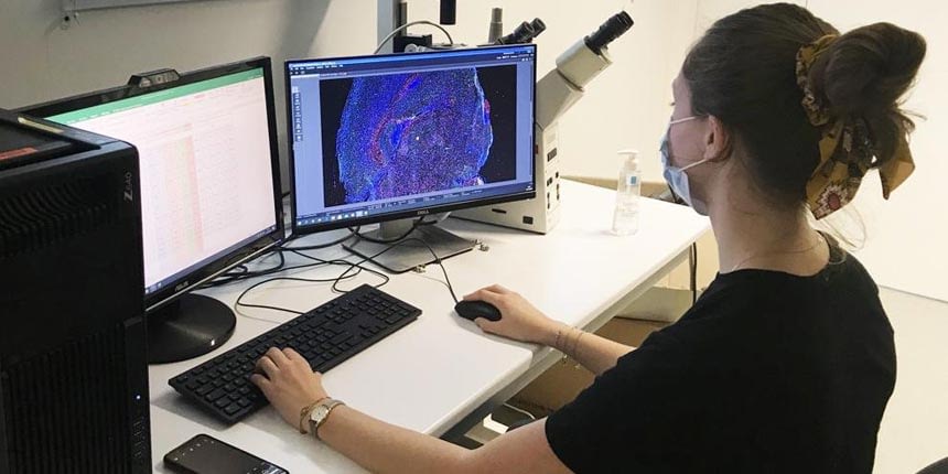 Effet des mutationsIDH1 et CIC
